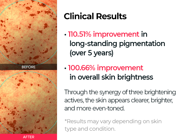 DR.MELAXIN TX-ASTAXANTHIN TRIPLE BRIGHTENING JELLY SERUM Rozjaśniające serum na przebarwienia 30 ml #7